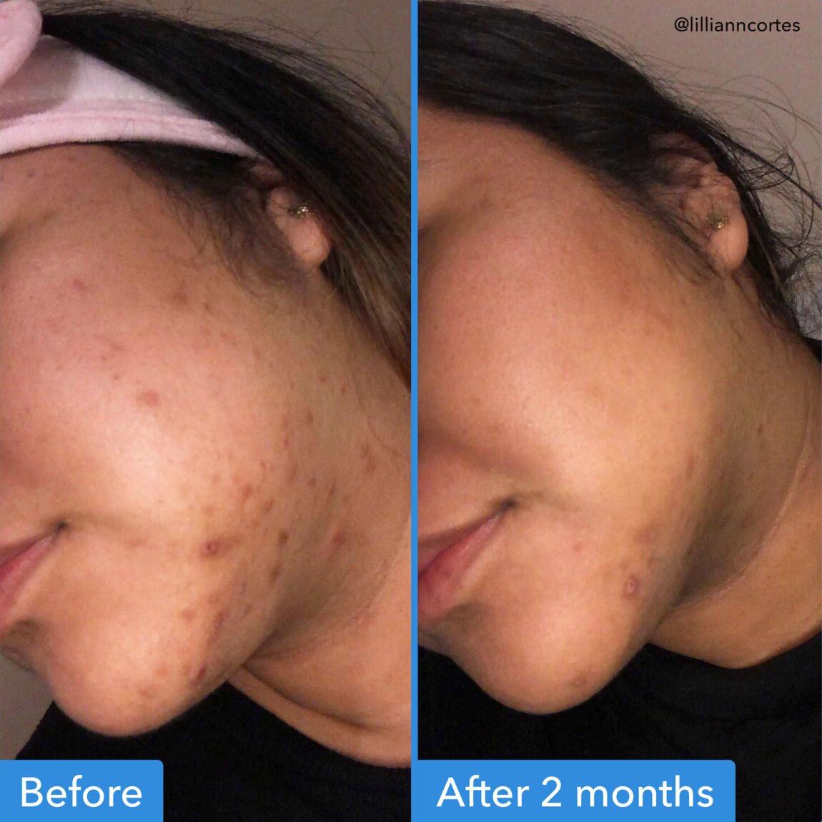 discoloration-correcting-serum-r4 zb_p.jpg