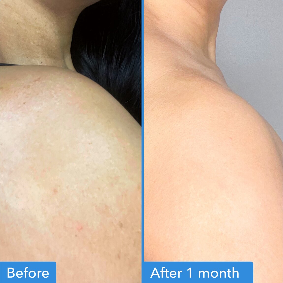 discoloration-correcting-body-treatment-m8 zb_p.jpg