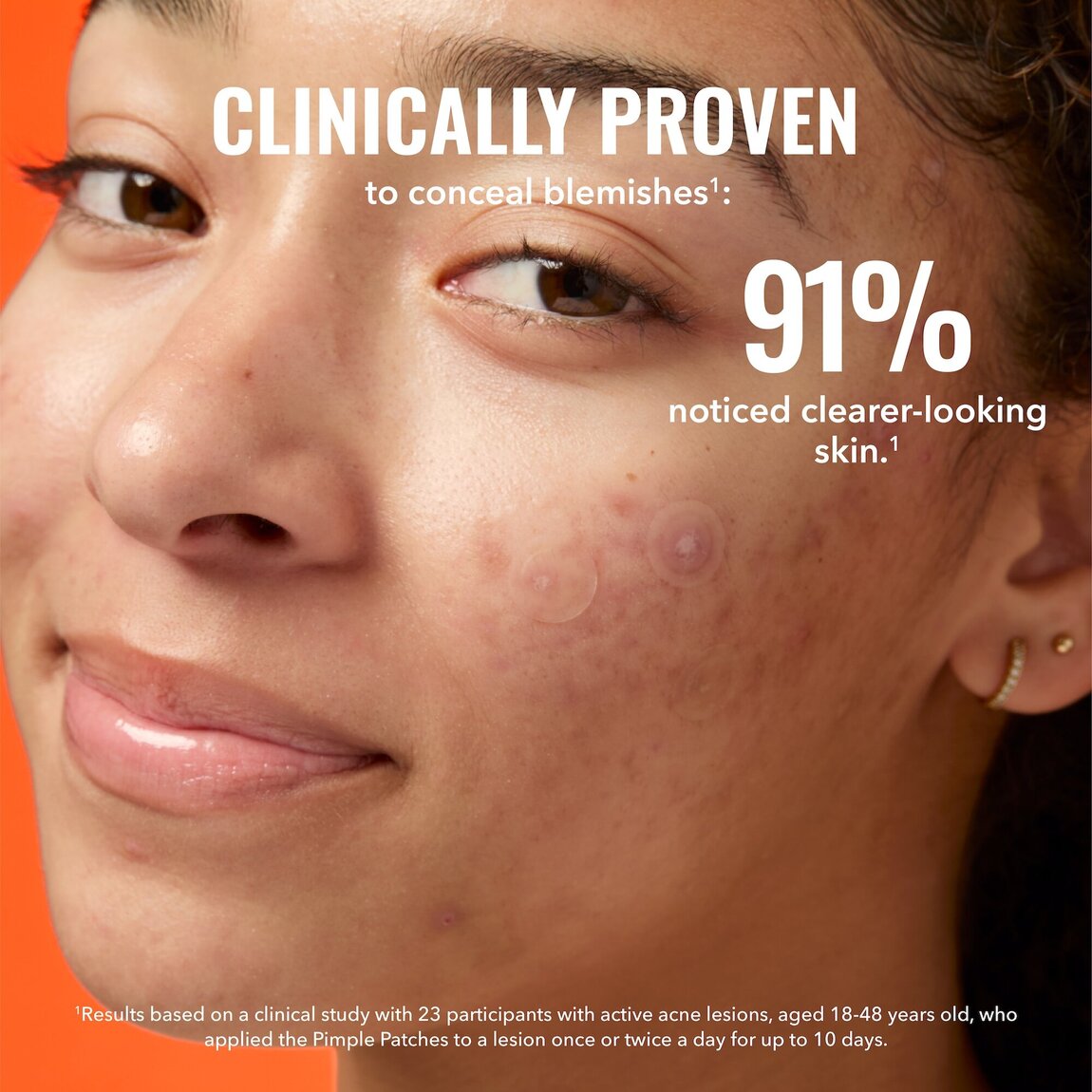 pimple-patches-p8 zb_p.jpg