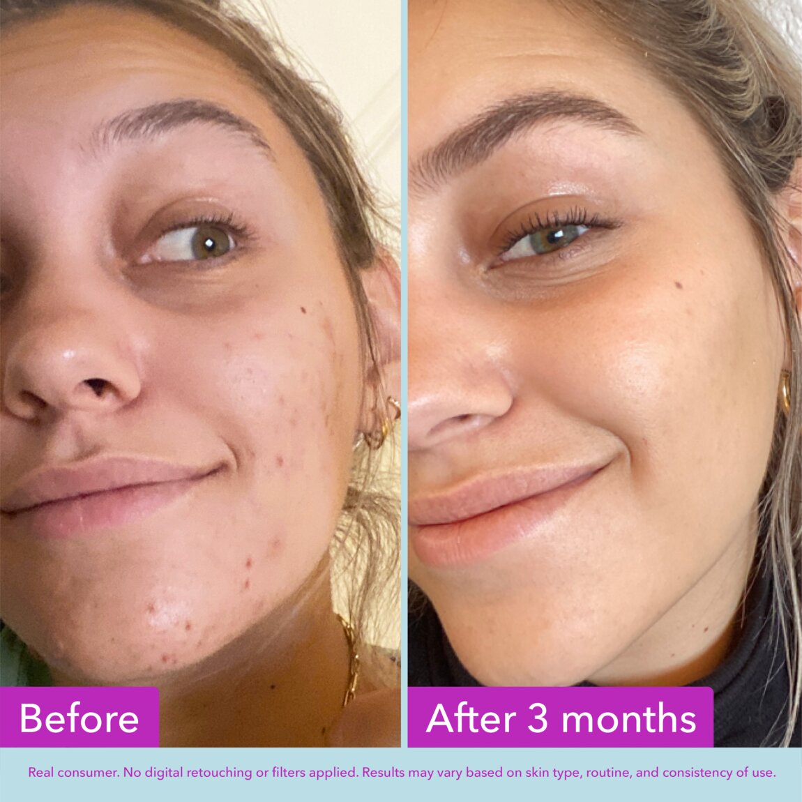 niacinamide-brightening-toner-b8 zb_p.jpg