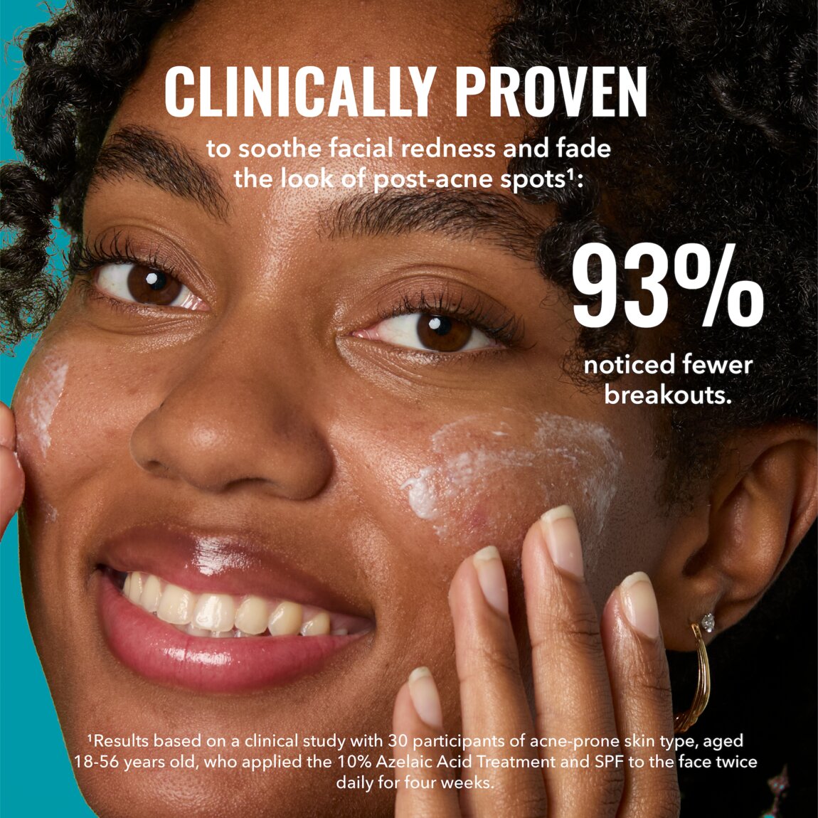 10-azelaic-acid-treatment-f9 zb_p.jpg